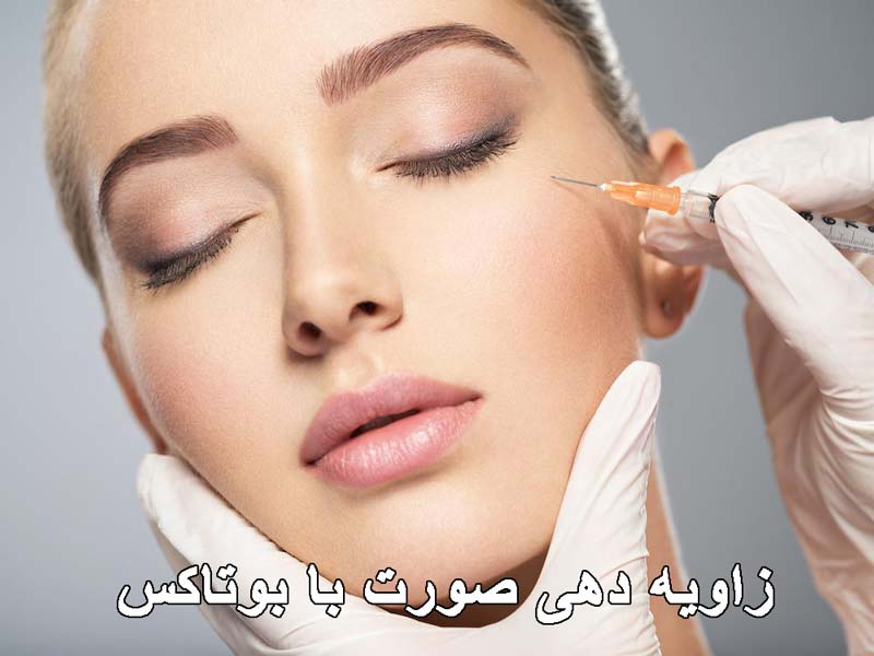 زاویه دهی صورت با بوتاکس